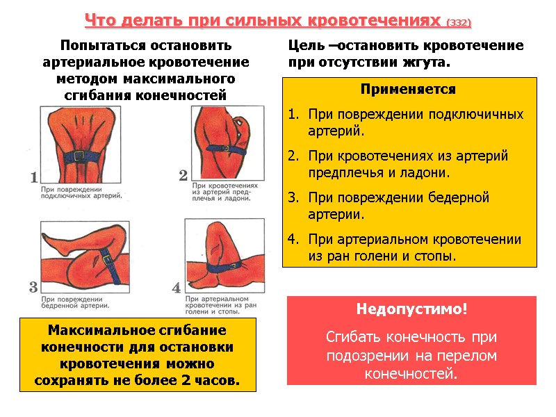 Что делать при сильных кровотечениях (332) Попытаться остановить артериальное кровотечение методом максимального сгибания конечностей